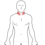 Brachial Plexus